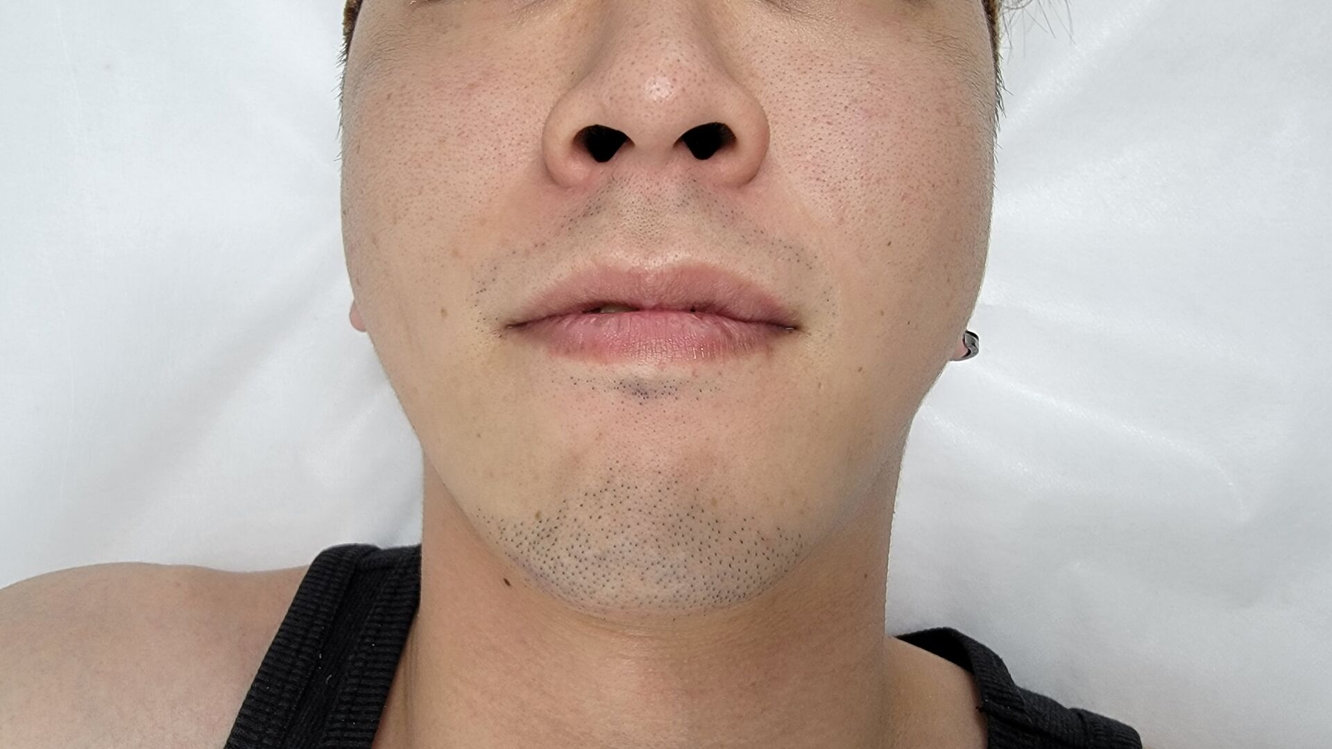 before画像